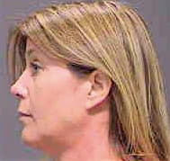 Bishop Monica - Sarasota County, FL 